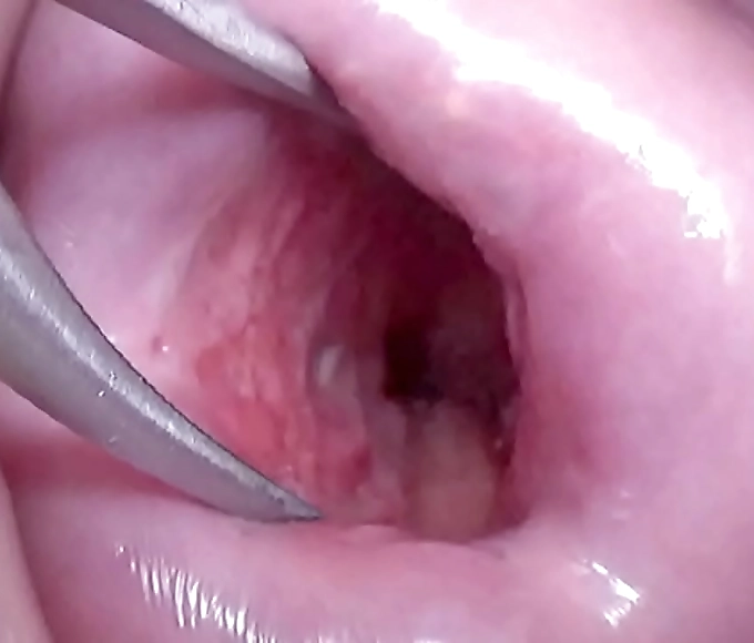 Japanese Wife's Irresistible Cervix: A Peek Inside Her Uterus